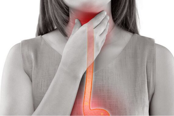 achalasia, achalasia causes, achalasia symptoms